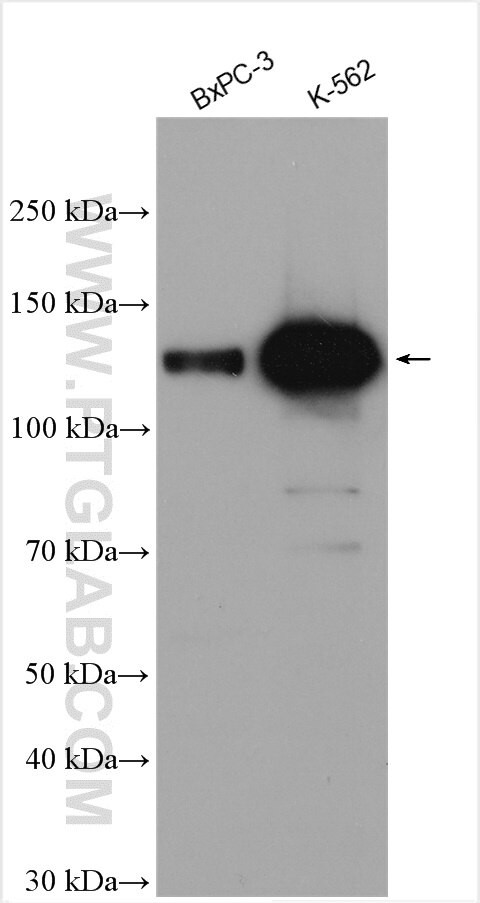 USP25 Antibody in Western Blot (WB)