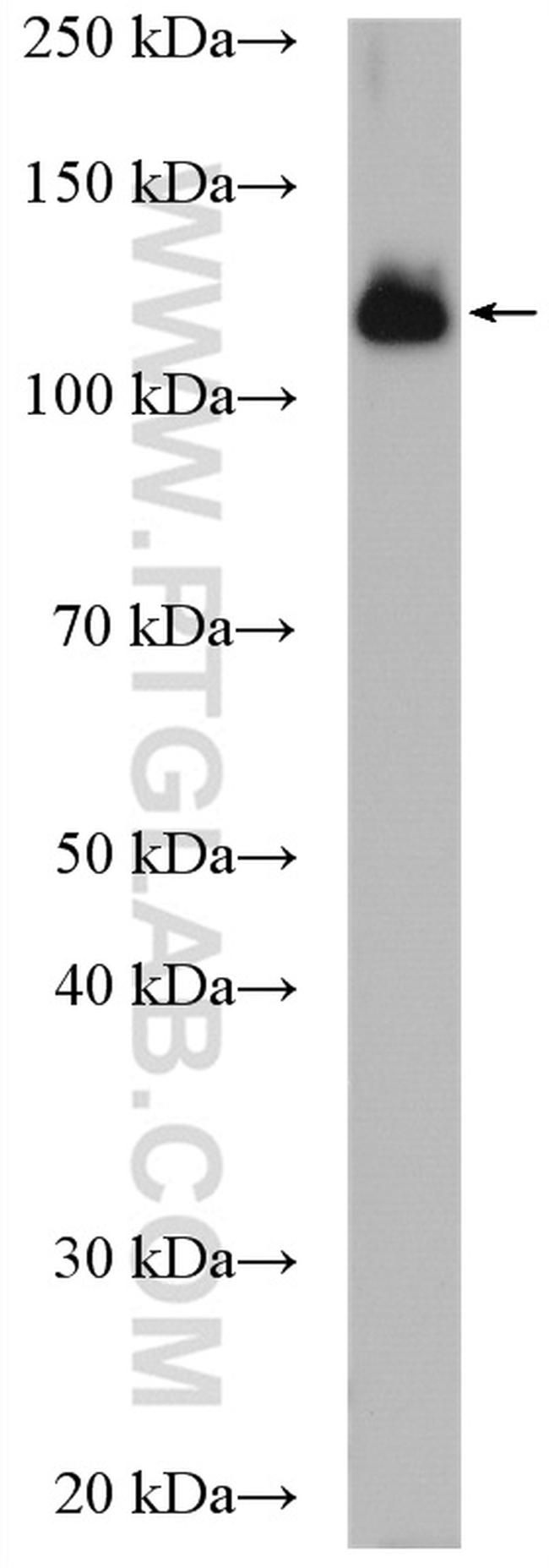 USP25 Antibody in Western Blot (WB)