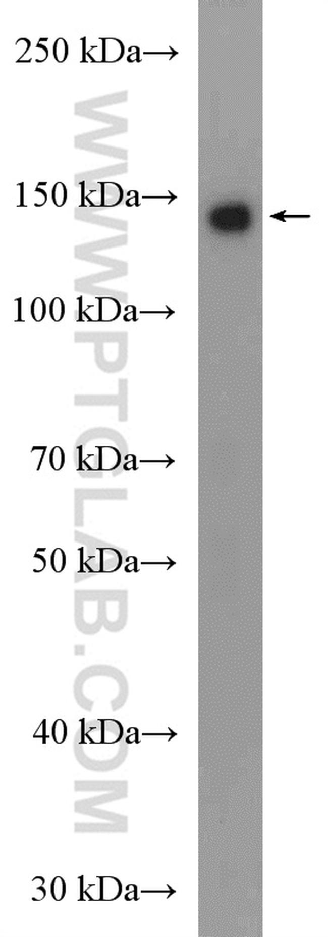 USP25 Antibody in Western Blot (WB)