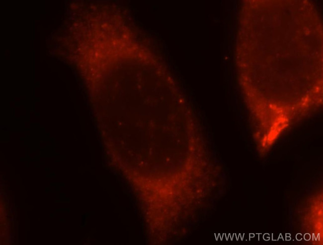 ABHD5 Antibody in Immunocytochemistry (ICC/IF)