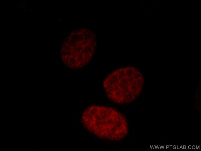 MATR3 Antibody in Immunocytochemistry (ICC/IF)