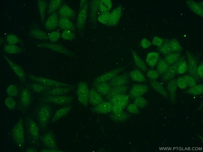 TRIM27 Antibody in Immunocytochemistry (ICC/IF)