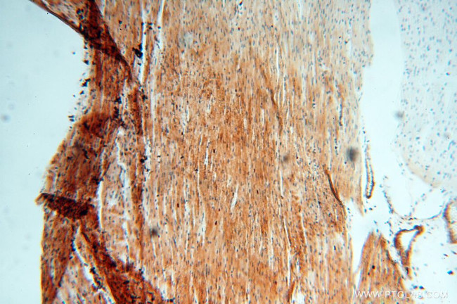 TRIM27 Antibody in Immunohistochemistry (Paraffin) (IHC (P))