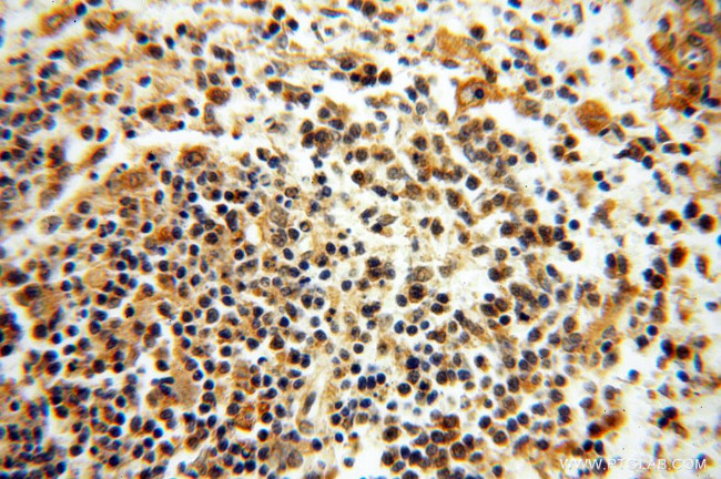 TRIM27 Antibody in Immunohistochemistry (Paraffin) (IHC (P))