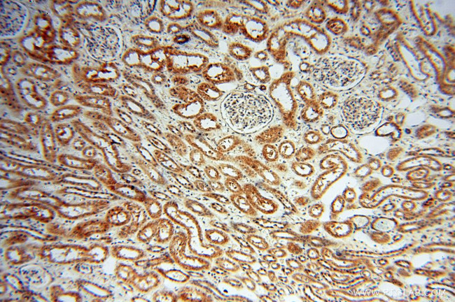 TRIM27 Antibody in Immunohistochemistry (Paraffin) (IHC (P))