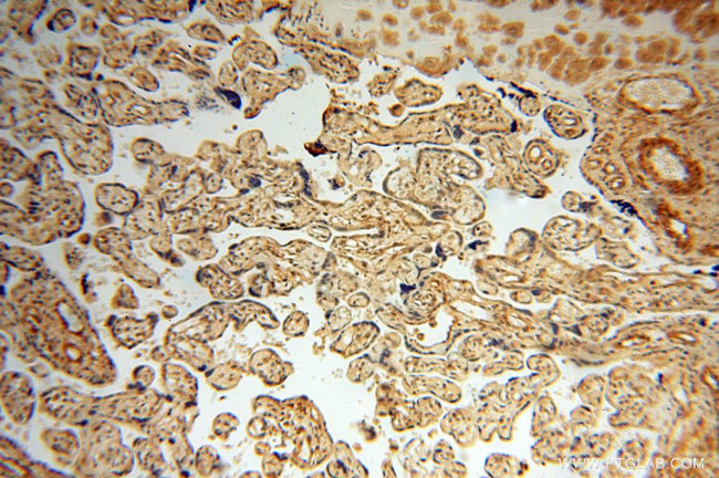 TRIM27 Antibody in Immunohistochemistry (Paraffin) (IHC (P))