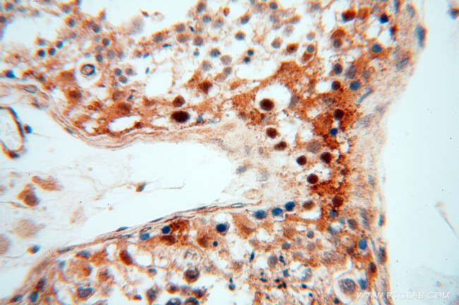 TRIM27 Antibody in Immunohistochemistry (Paraffin) (IHC (P))