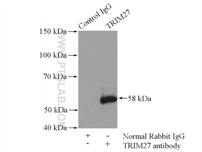 TRIM27 Antibody in Immunoprecipitation (IP)