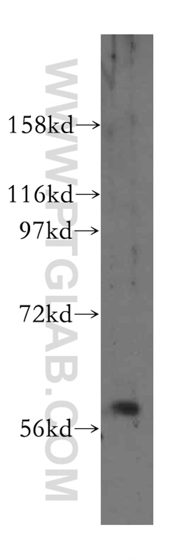 TRIM27 Antibody in Western Blot (WB)