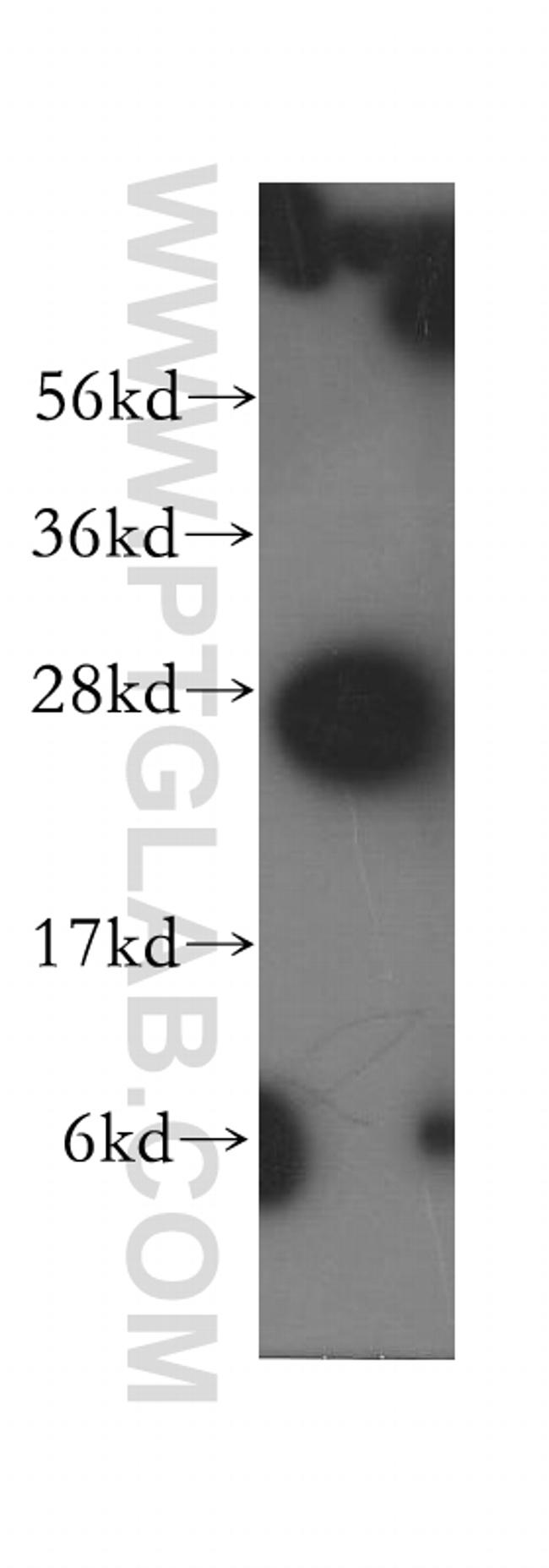 Syntaxin 8 Antibody in Western Blot (WB)