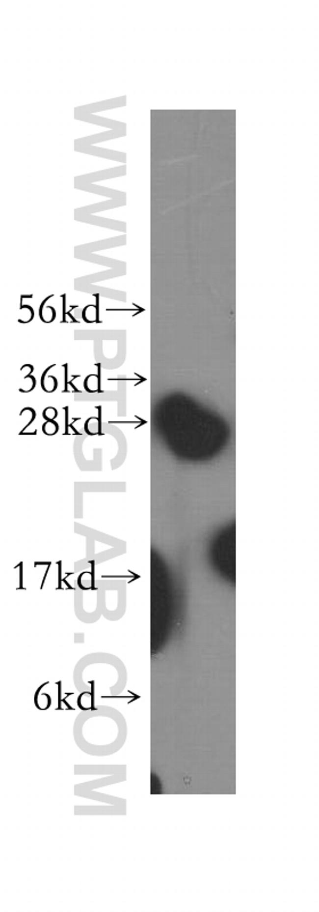 Syntaxin 8 Antibody in Western Blot (WB)