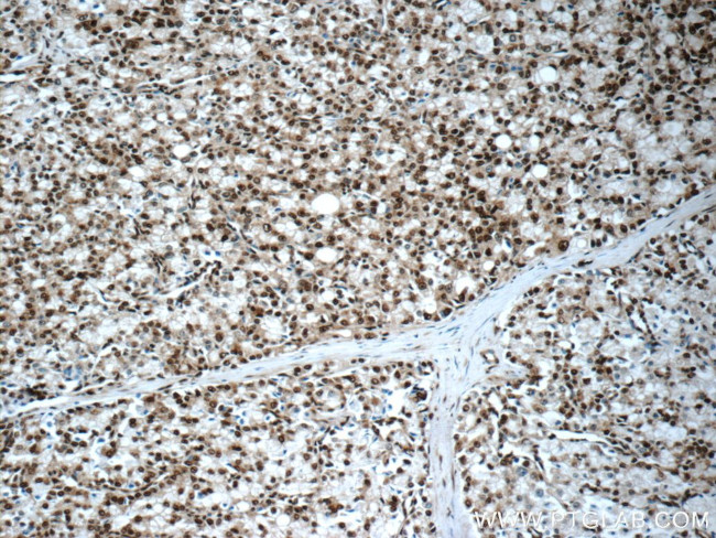 CREB1 Antibody in Immunohistochemistry (Paraffin) (IHC (P))