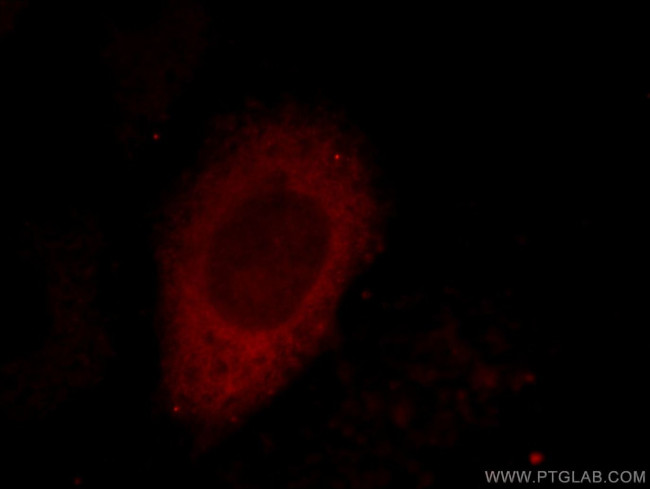 CTRP1 Antibody in Immunocytochemistry (ICC/IF)