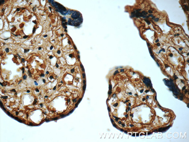 CTRP1 Antibody in Immunohistochemistry (Paraffin) (IHC (P))