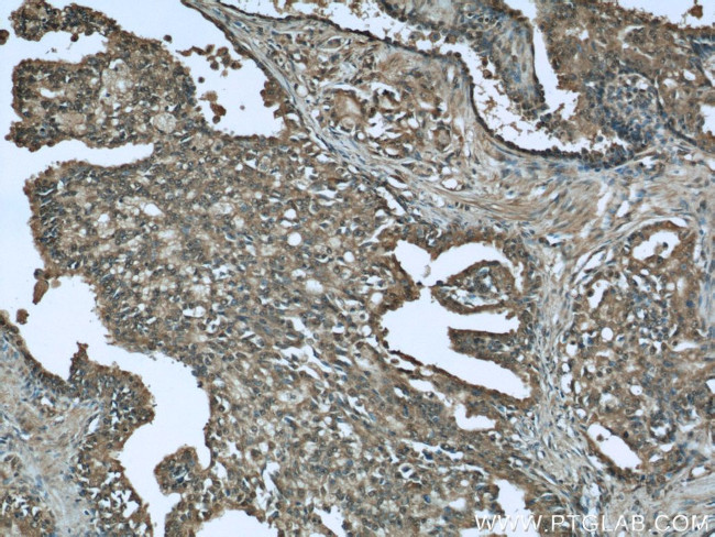 CTRP1 Antibody in Immunohistochemistry (Paraffin) (IHC (P))