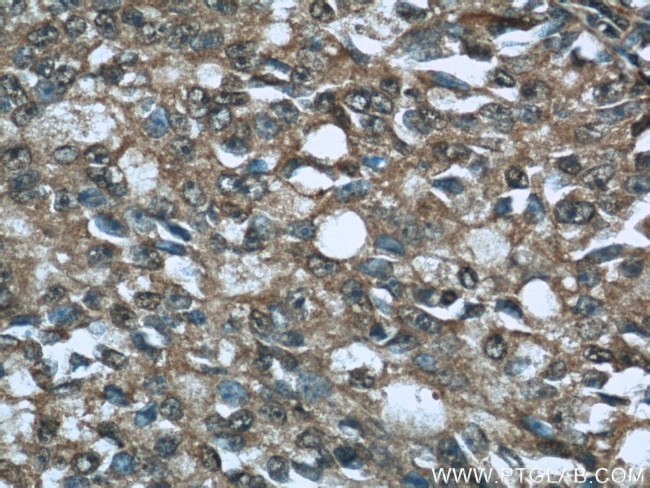 CTRP1 Antibody in Immunohistochemistry (Paraffin) (IHC (P))