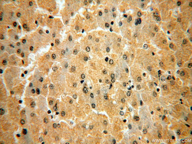 CPOX Antibody in Immunohistochemistry (Paraffin) (IHC (P))