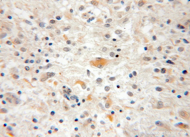 CPOX Antibody in Immunohistochemistry (Paraffin) (IHC (P))