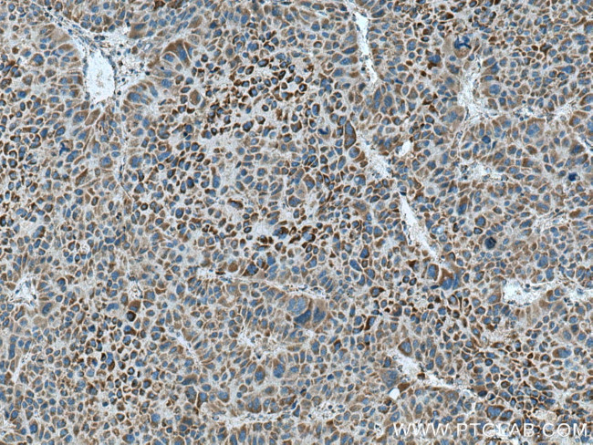 CPOX Antibody in Immunohistochemistry (Paraffin) (IHC (P))