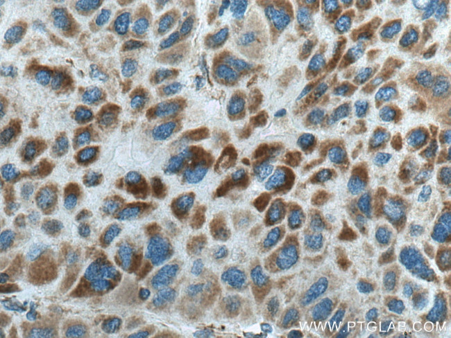 CPOX Antibody in Immunohistochemistry (Paraffin) (IHC (P))