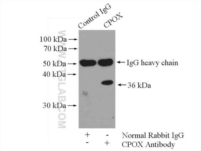 CPOX Antibody in Immunoprecipitation (IP)