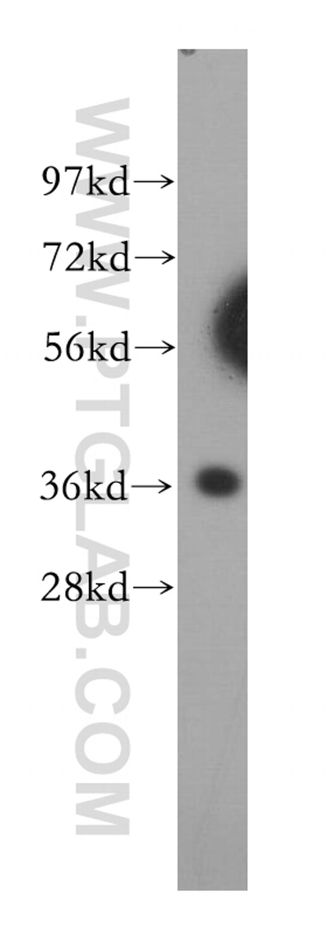 CPOX Antibody in Western Blot (WB)