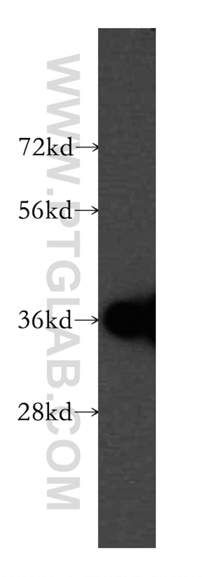 CPOX Antibody in Western Blot (WB)