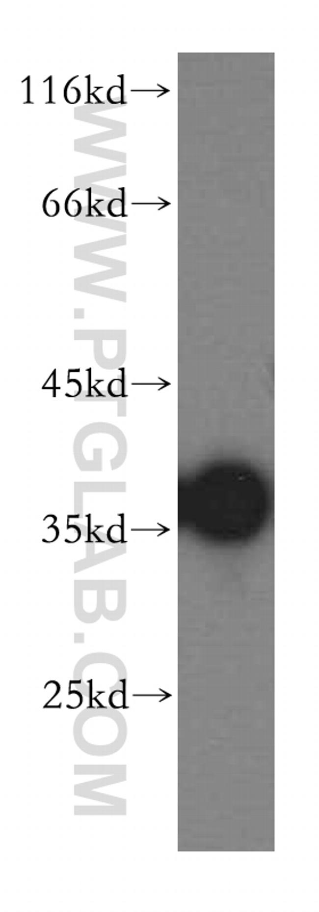 CPOX Antibody in Western Blot (WB)