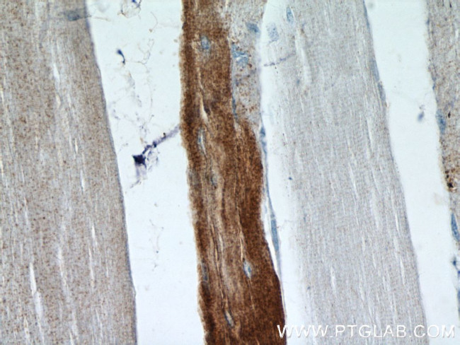 MARCH5 Antibody in Immunohistochemistry (Paraffin) (IHC (P))