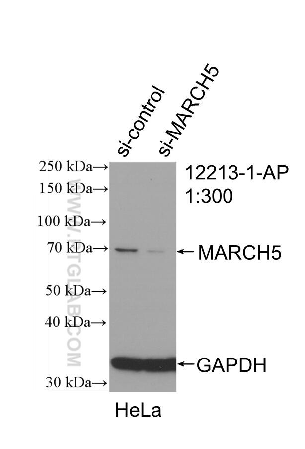 MARCH5 Antibody in Western Blot (WB)