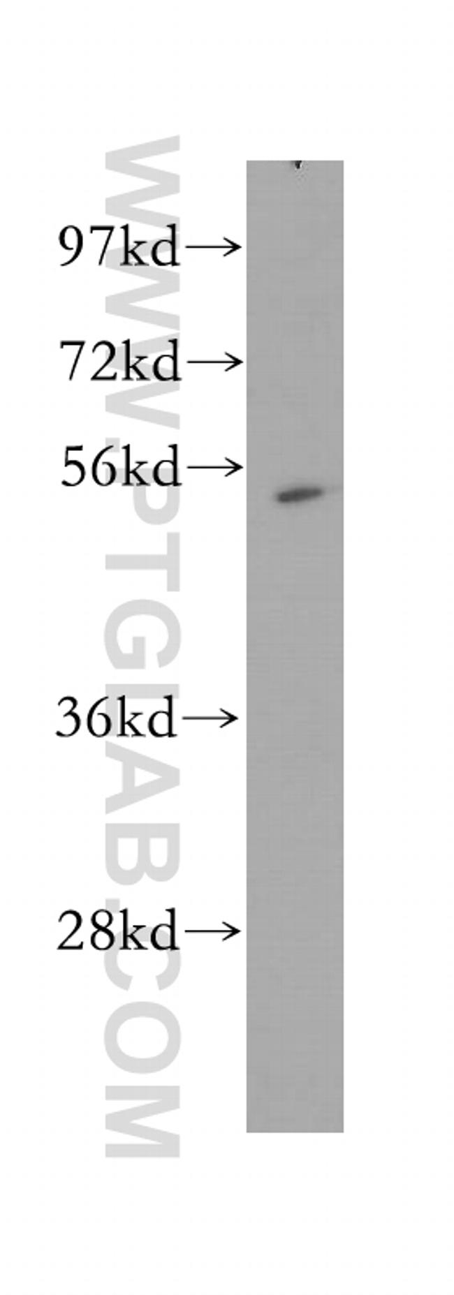 MINA Antibody in Western Blot (WB)