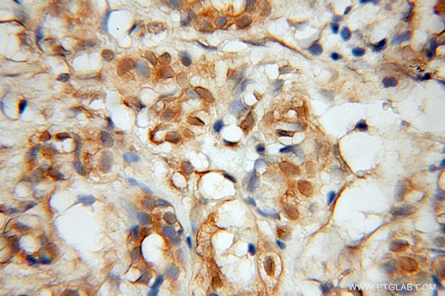 MINA Antibody in Immunohistochemistry (Paraffin) (IHC (P))