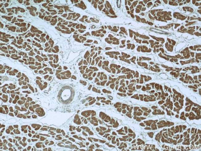 PDK3 Antibody in Immunohistochemistry (Paraffin) (IHC (P))