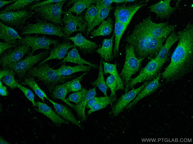 Cathepsin B Antibody in Immunocytochemistry (ICC/IF)