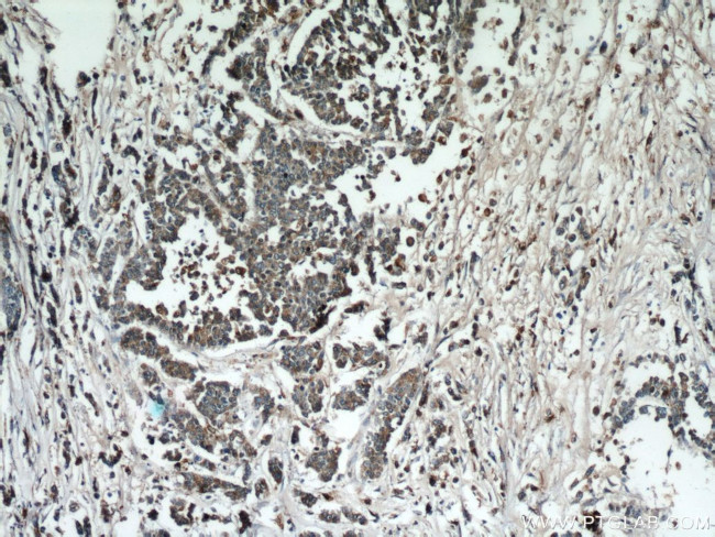 Cathepsin B Antibody in Immunohistochemistry (Paraffin) (IHC (P))