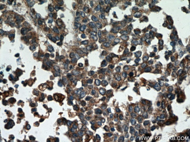 Cathepsin B Antibody in Immunohistochemistry (Paraffin) (IHC (P))