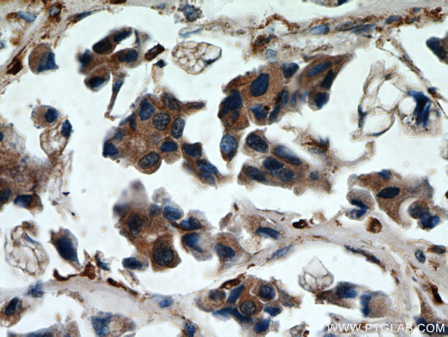 Cathepsin B Antibody in Immunohistochemistry (Paraffin) (IHC (P))