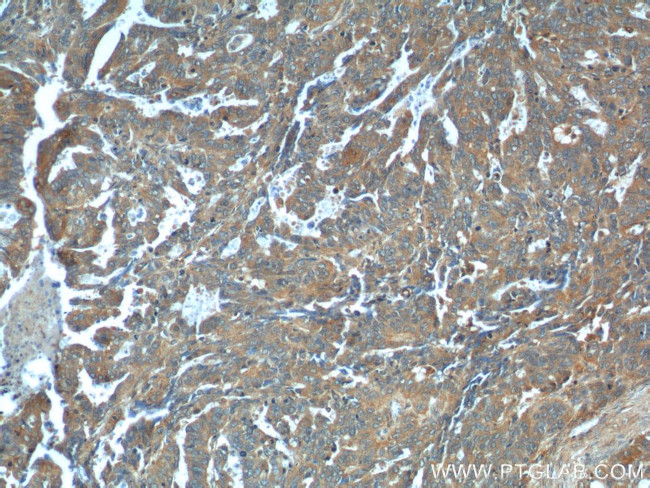 Cathepsin B Antibody in Immunohistochemistry (Paraffin) (IHC (P))