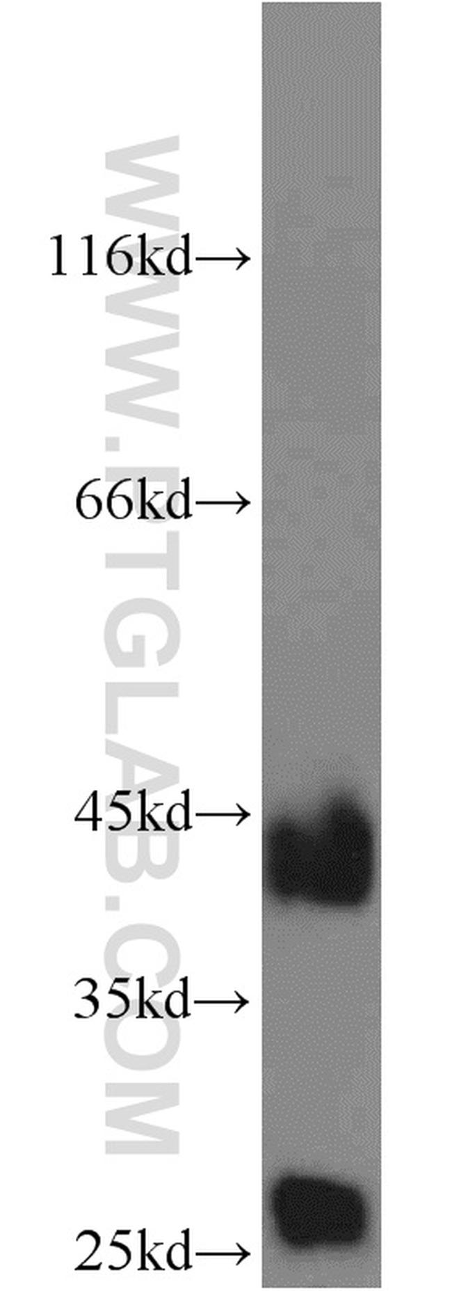 Cathepsin B Antibody in Western Blot (WB)