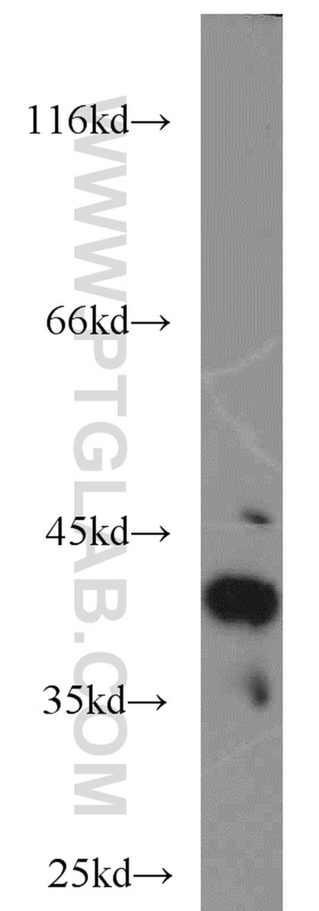 Cathepsin B Antibody in Western Blot (WB)