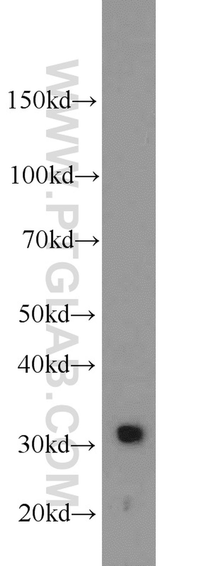 Cathepsin B Antibody in Western Blot (WB)