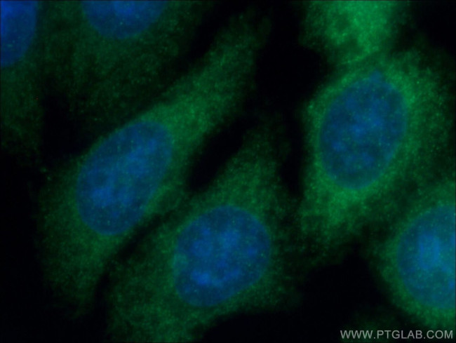 Gamma cystathionase Antibody in Immunocytochemistry (ICC/IF)