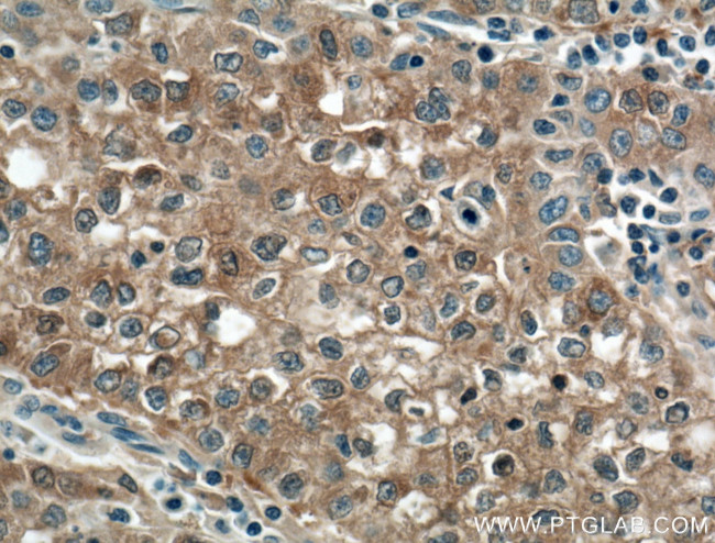 Gamma cystathionase Antibody in Immunohistochemistry (Paraffin) (IHC (P))