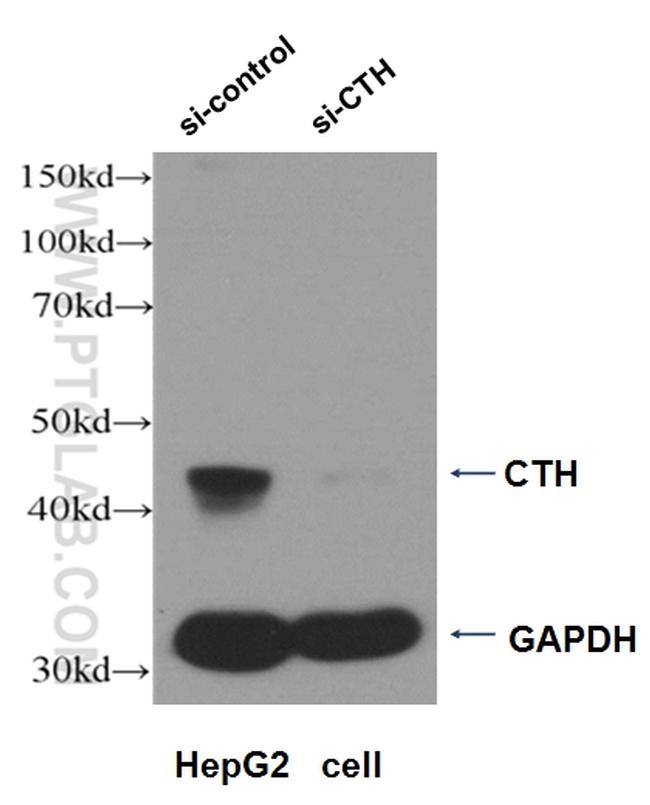 Gamma cystathionase Antibody in Western Blot (WB)