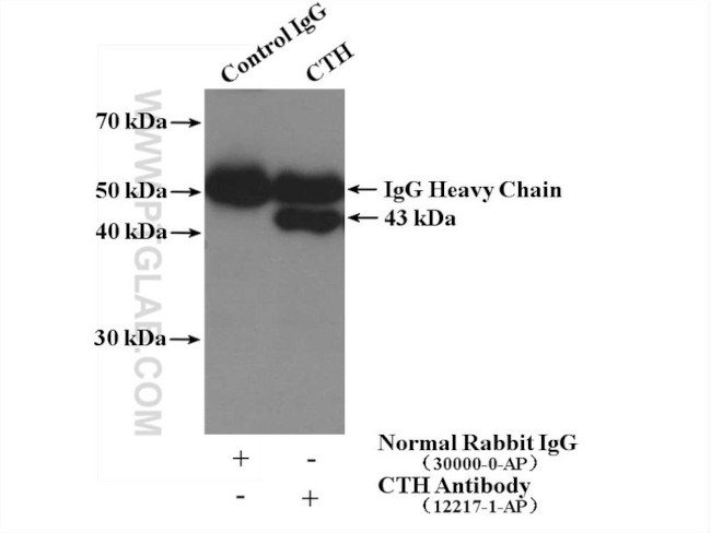 Gamma cystathionase Antibody in Immunoprecipitation (IP)