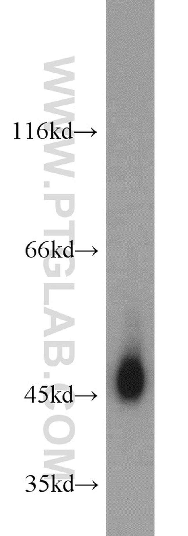 Gamma cystathionase Antibody in Western Blot (WB)