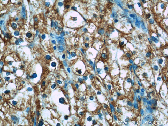 BMP7 Antibody in Immunohistochemistry (Paraffin) (IHC (P))