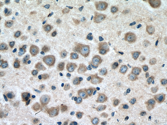 BMP7 Antibody in Immunohistochemistry (Paraffin) (IHC (P))