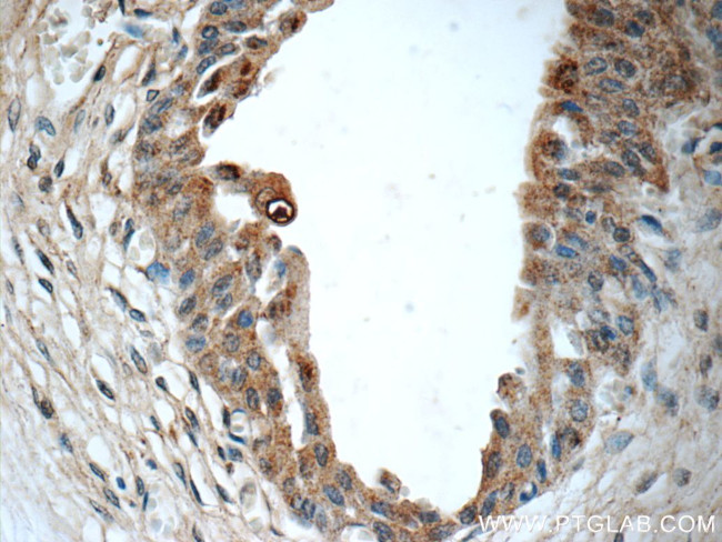 BMP7 Antibody in Immunohistochemistry (Paraffin) (IHC (P))