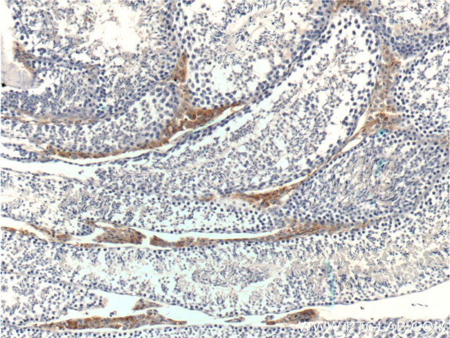 STAR Antibody in Immunohistochemistry (Paraffin) (IHC (P))